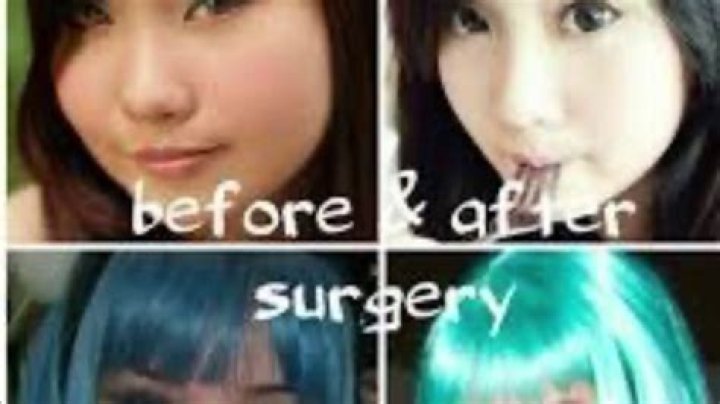 Alodia Gosiengfiao Plastic Surgery: Before And After Photos