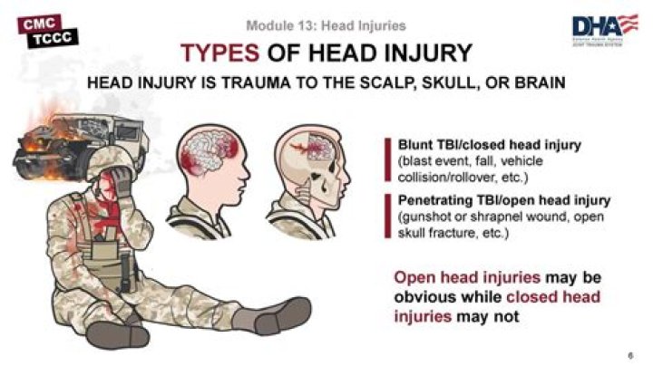Anthony Miranda Shot In Head, Eye Injury: What Happened To Him?