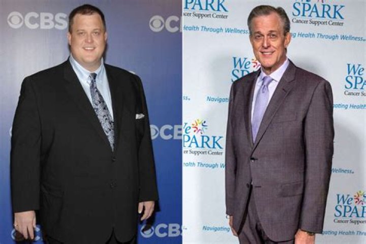 Billy Gardell Illness And Health Update: Did He Have Weight Loss Surgery, How Much Weight Did He Lose?