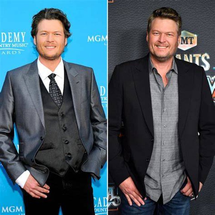 
Blake Shelton Weight Loss Journey – Before And After Photos, Diet And Workout 
