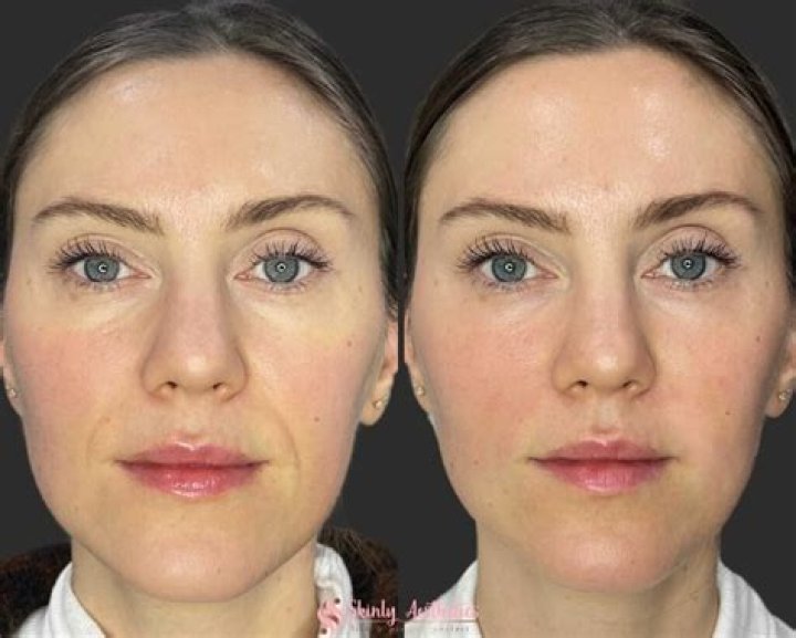 Debra Jo Rupp Plastic Surgery Procedure Might Have Included Fine Lines Removal