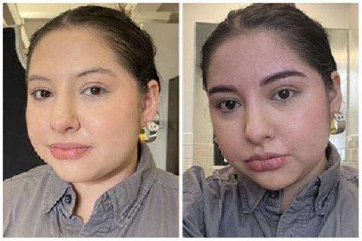 Did Mikhaila Peterson Ever Undergo Plastic Surgery? Before And After Pics Of The Podcaster
