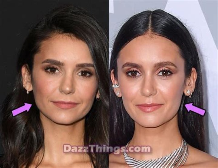 
Did Nina Dobrev Get Plastic Surgery? Who is Nina Dobrev? Nina Dobrev’s Net Worth 