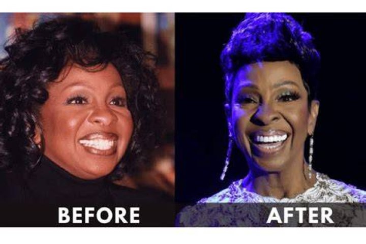 Gladys Knight Illness And Weight Loss Explained: Where Is The Seven-time Grammy Award-winning Singer Today?