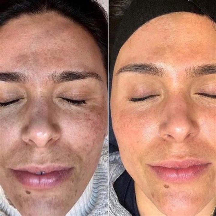 
Here’s Everything You Need to Know About Why Is Charla Nash’s Face So Different 