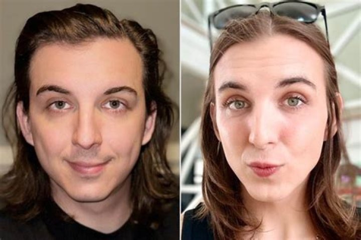 
Is Chris Tyson Transgender? Before And After Plastic Surgery Photos 