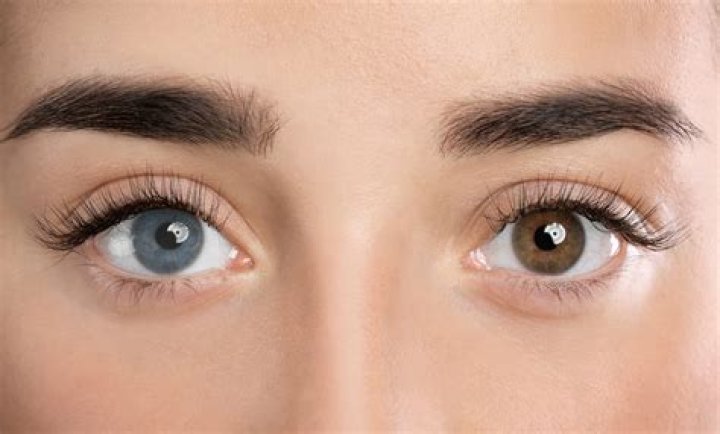 
Kate Bosworth Stated That She Used To Cover Up Her Heterochromia With Colored Contacts 