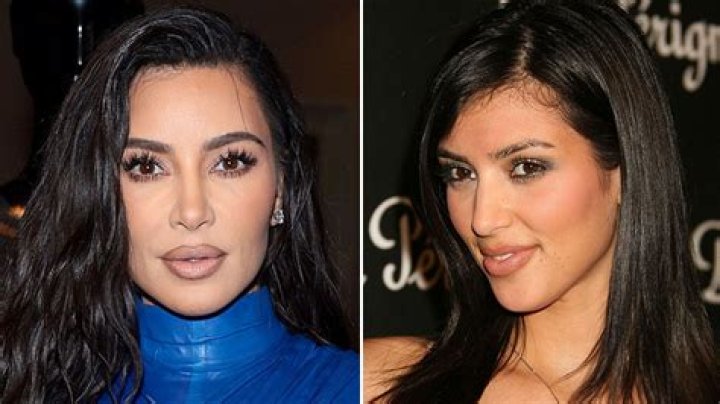 
Kim Kardashian Before And After Looks: The Socialite’s Plastic Surgery Journey Explained 