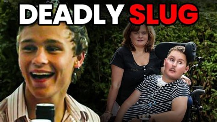 
Story: Sam Ballard Ate Slug Of Rat Lungworm On Dare – Rugby Player Death 