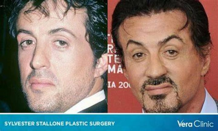 Sylvester Stallone’s Tattoos, Plastic Surgery and Body Transformation Then and Now