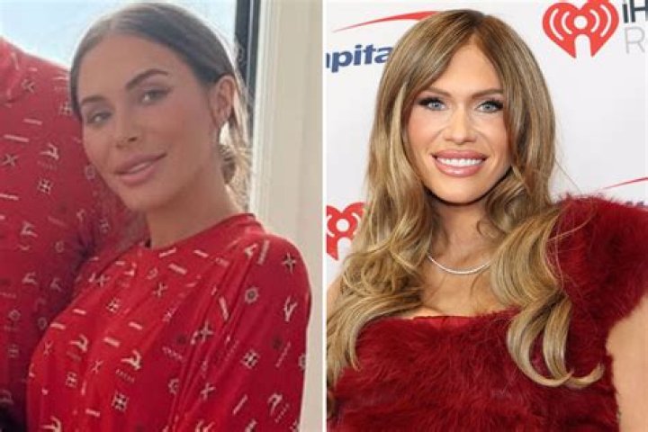 TS Madison Plastic Surgery – Before And After Photos Explored